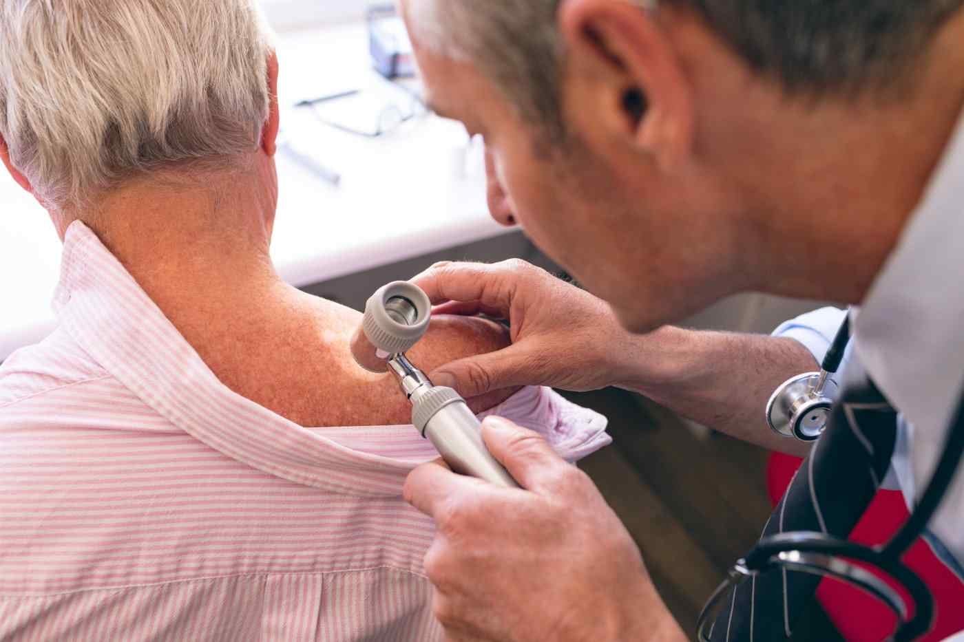 man getting skin cancer checkup from gp