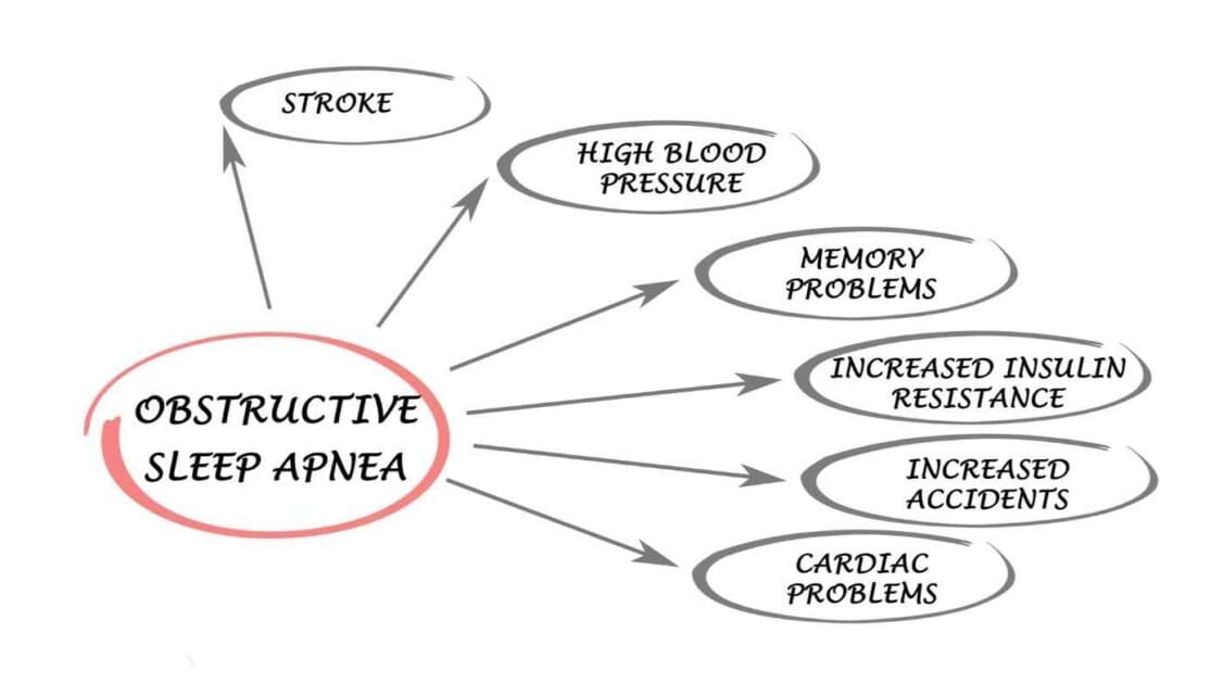 diagram showing what sleep apnea can cause