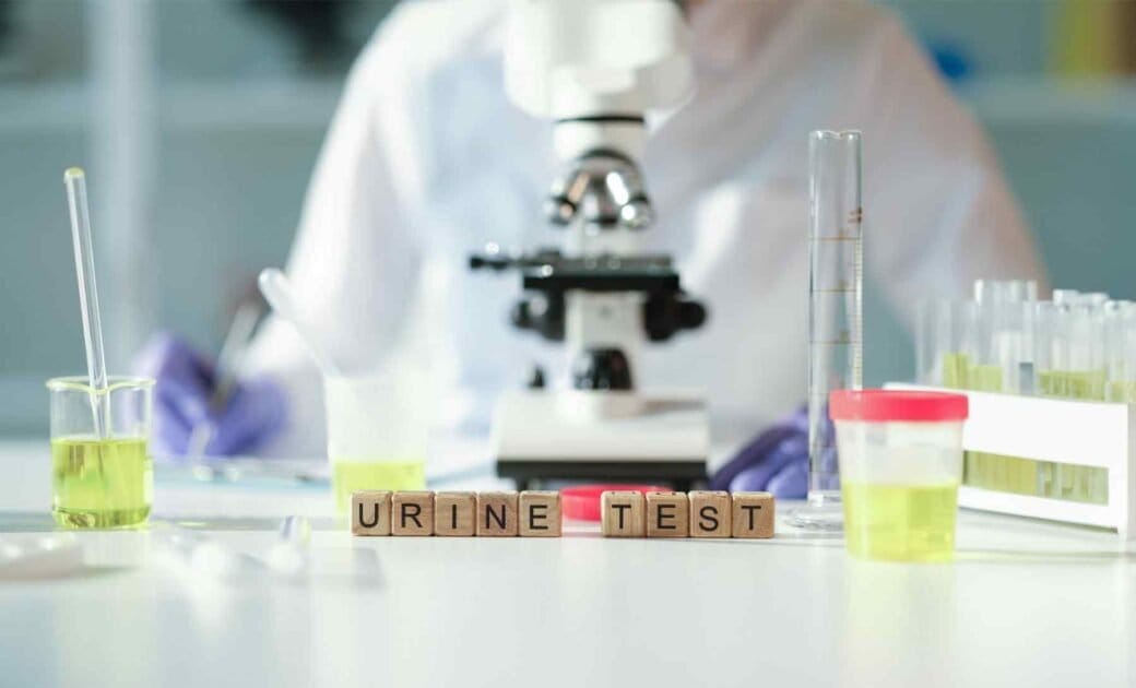 Urine Tests